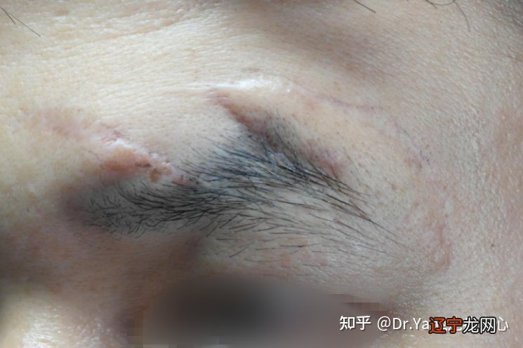 组图 这10种眉毛，该改离婚感情受挫严重!