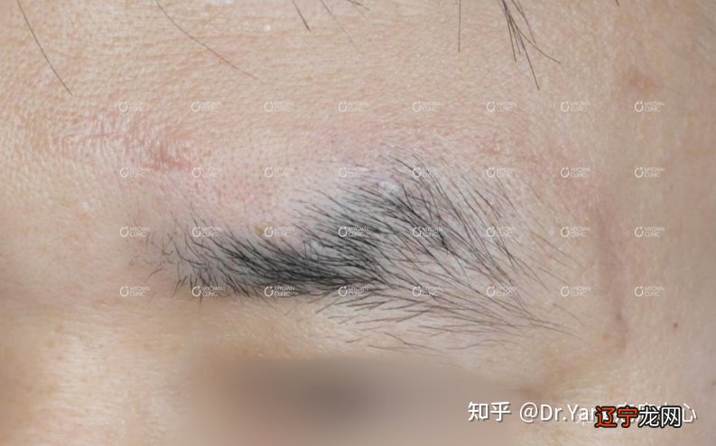 组图 这10种眉毛，该改离婚感情受挫严重!