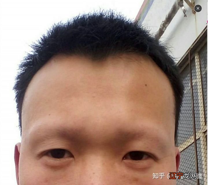 鬓角离眉毛太近相学_眉毛受伤有疤痕面相_相学面相全解有一根硬眉毛