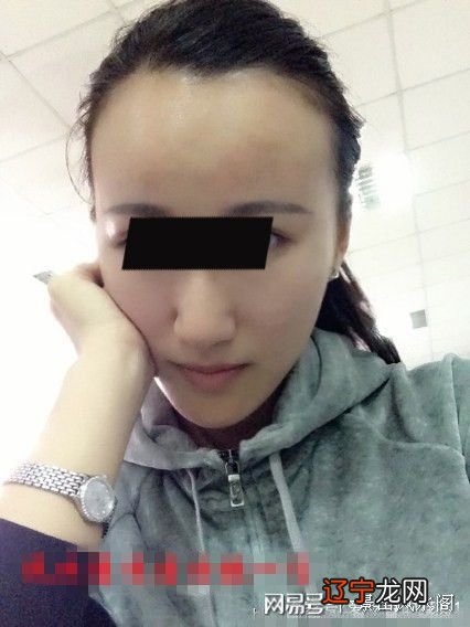 颧骨高的女性克夫相，女人克夫还表现在有黑斑有斜纹