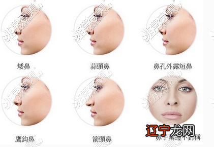 看鼻子面相_鼻子看几岁运势_从鼻孔看鼻子好不好看