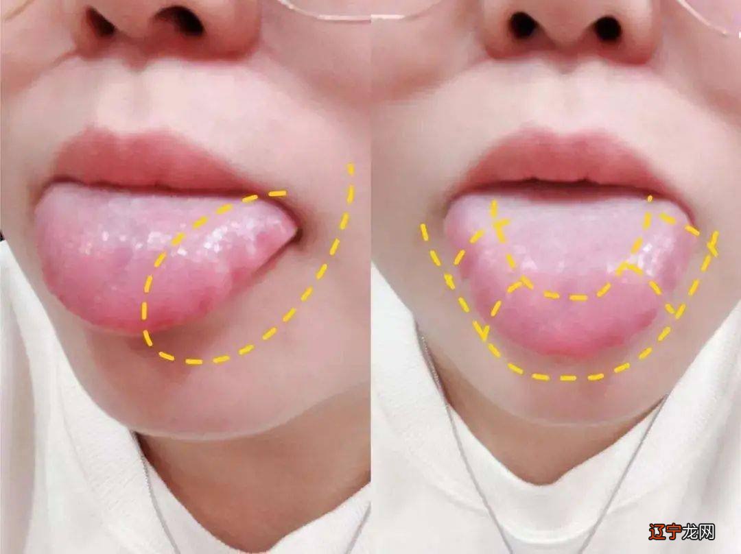 舌头看运势_看舌头知健康视频_中医看舌头口疮