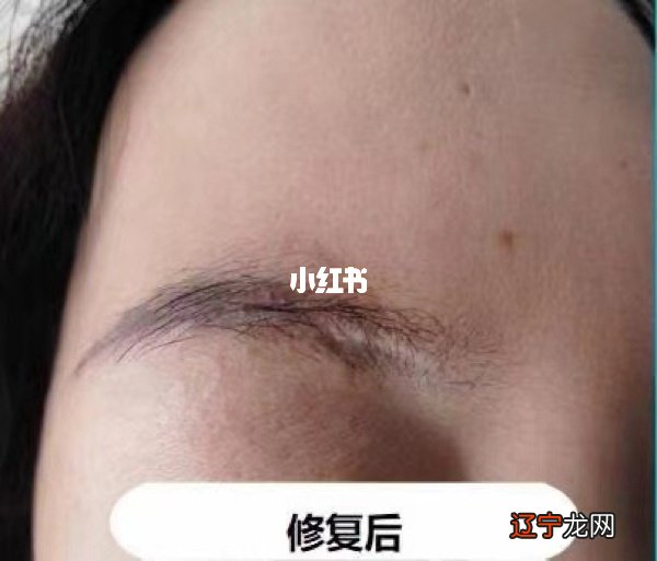 图 从眉毛有伤疤看一个人的面相如何?