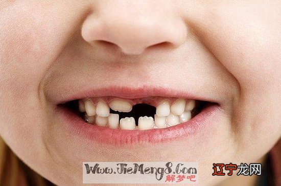 梦此风水堂：梦见牙齿掉的是什么意思