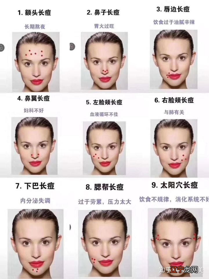 脸上长青春痘长在哪里?与成年期的区别?