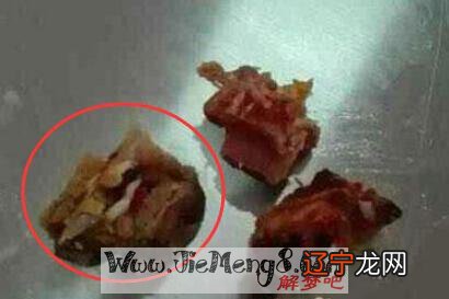 周公解梦：女人梦见厕所里的蛆虫是什么意思？