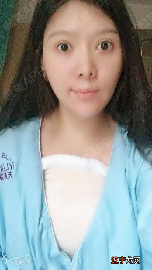 梦见隆胸流血，预示着做梦的人运势良好的因素