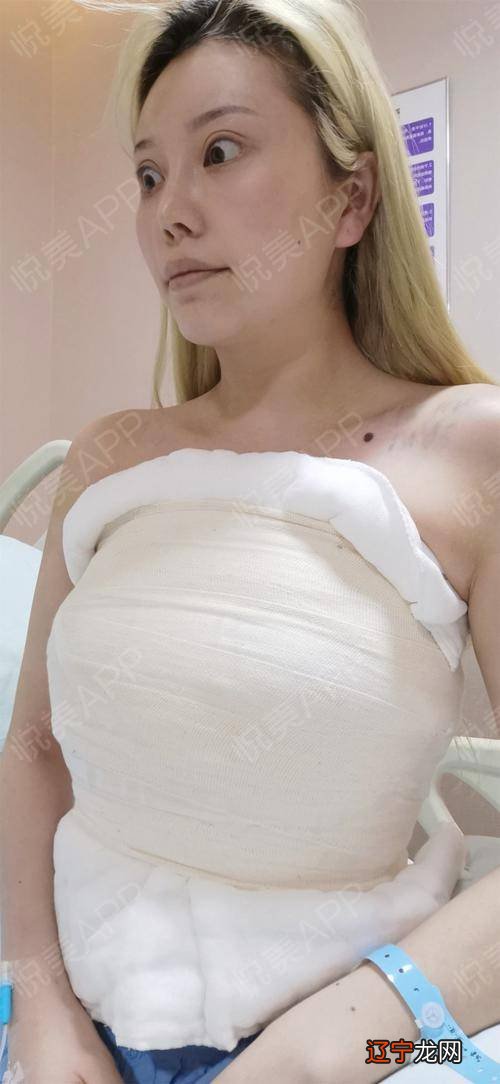 梦见隆胸流血，预示着做梦的人运势良好的因素