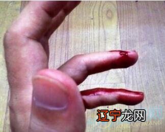 梦见别人手流血寓意，感兴趣的朋友们注意了！