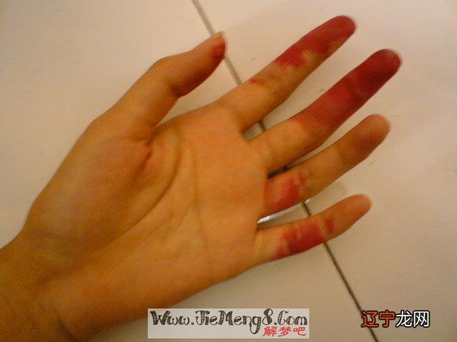 梦见别人手流血寓意，感兴趣的朋友们注意了！