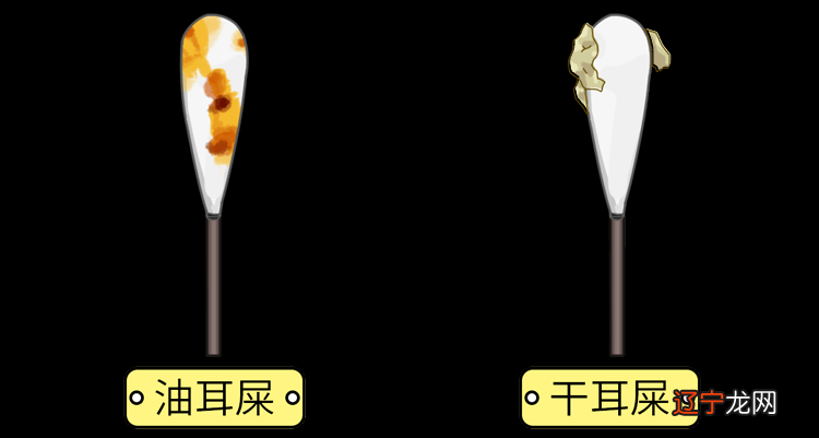耳鸣耳痒是怎么回事_耳痒占卜_狗立耳是不是特别痒