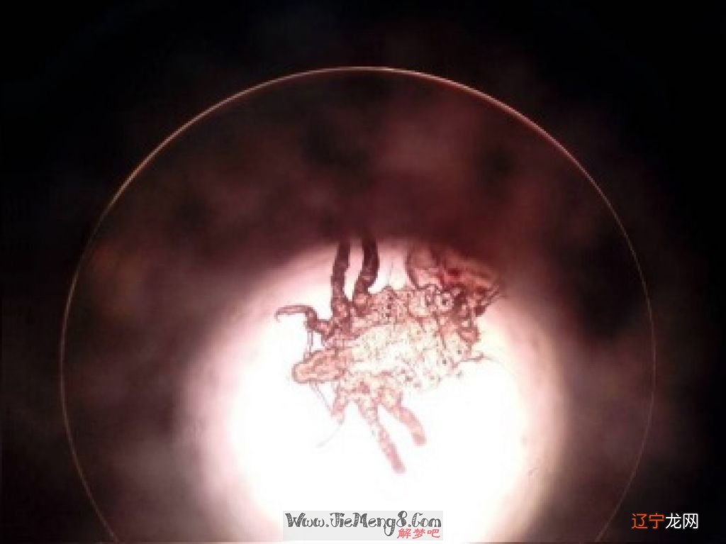 梦见身上爬满虫_梦见被蜱虫吸血_梦见身上满是吸血虫