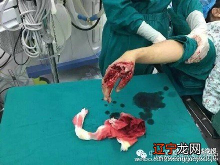 转发同行所作,深有同感,感恩节呼唤感恩的心! 中国医生的悲哀