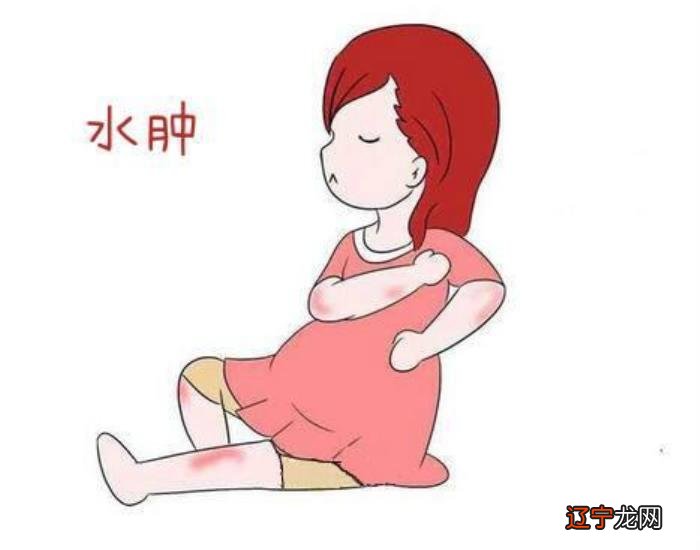 孕妇水肿怎么缓解 日常可以怎么做 孕妇水肿怎么缓解 改善孕妇水肿的方法